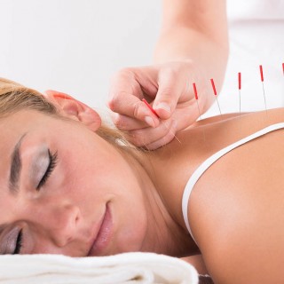 Naysay the needles? The power of acupuncture